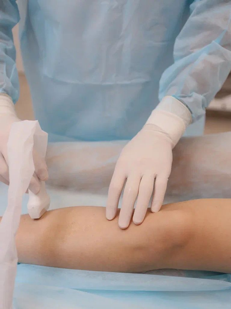 Check-up вен ног