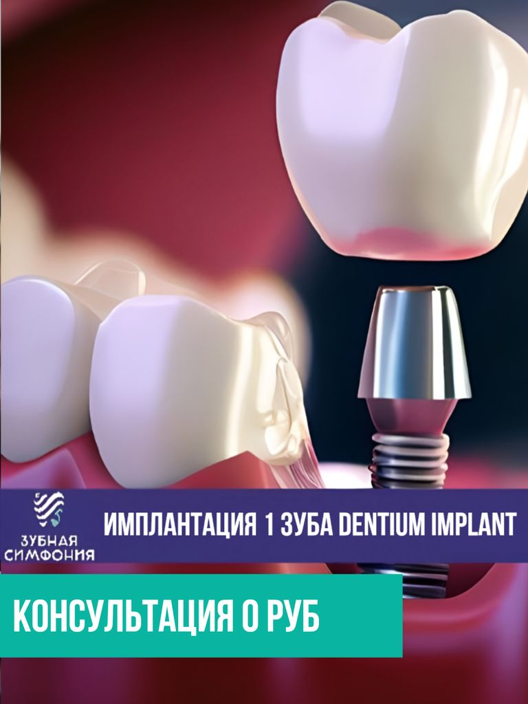 Имплантация 1 зуба Dentium IMPLANT «Под ключ» (Юж. Корея)