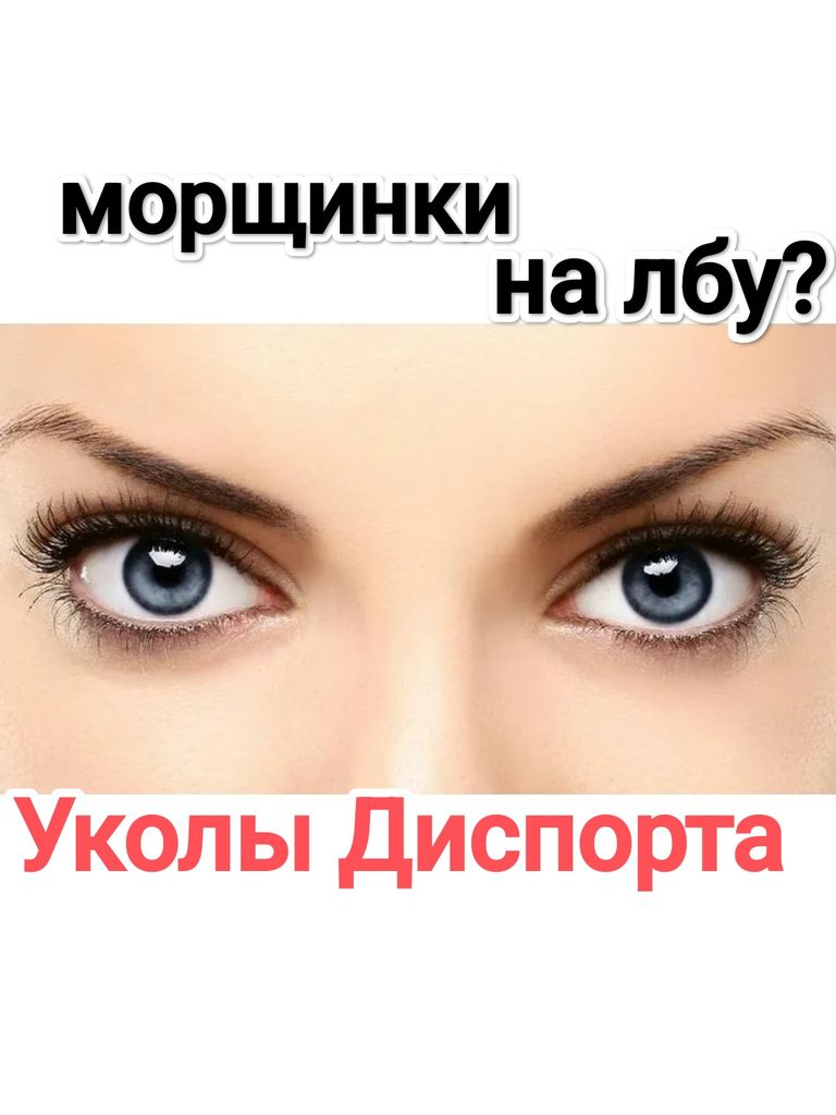 Инъекции препарата «Диспорт» в области лба, для коррекции мимических морщин