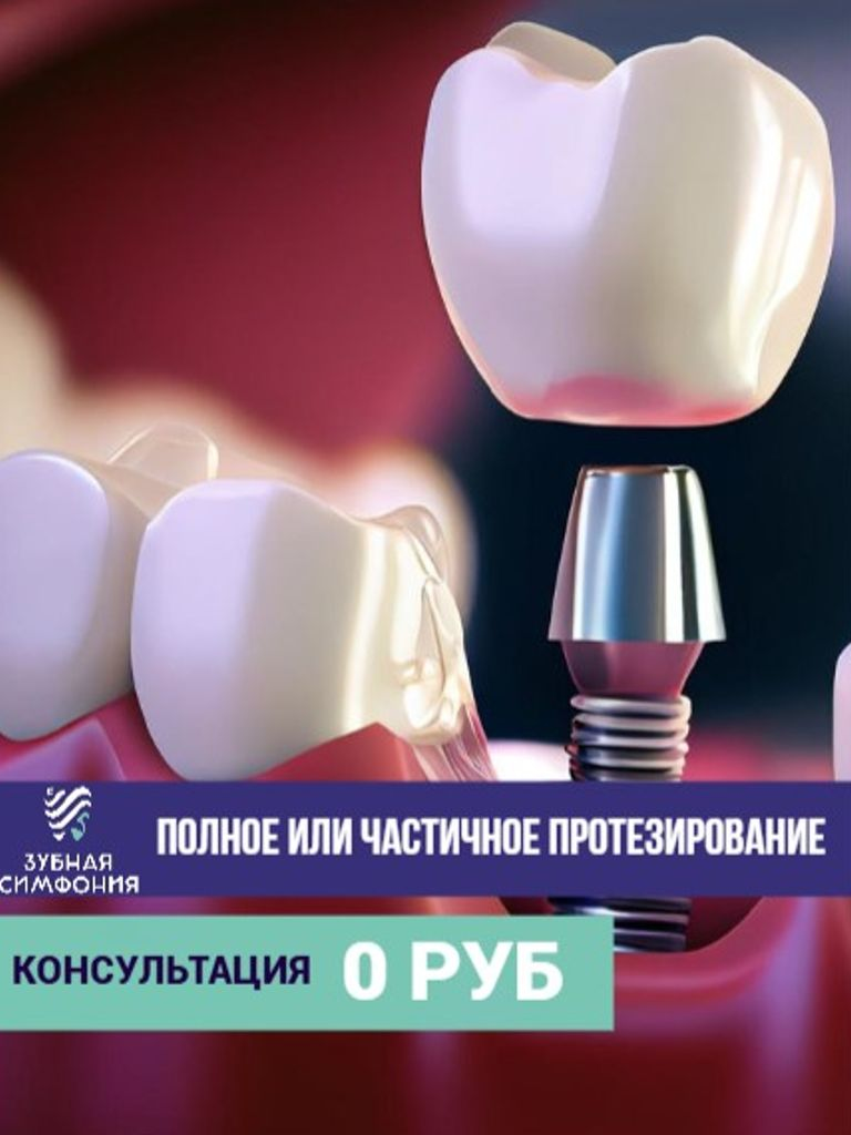 Полное или частичное протезирование (съемный акриловый протез), 1 челюсть