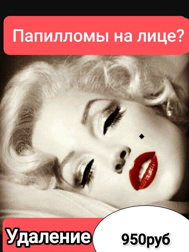 Удаление папиллом на лице до 3 мм.