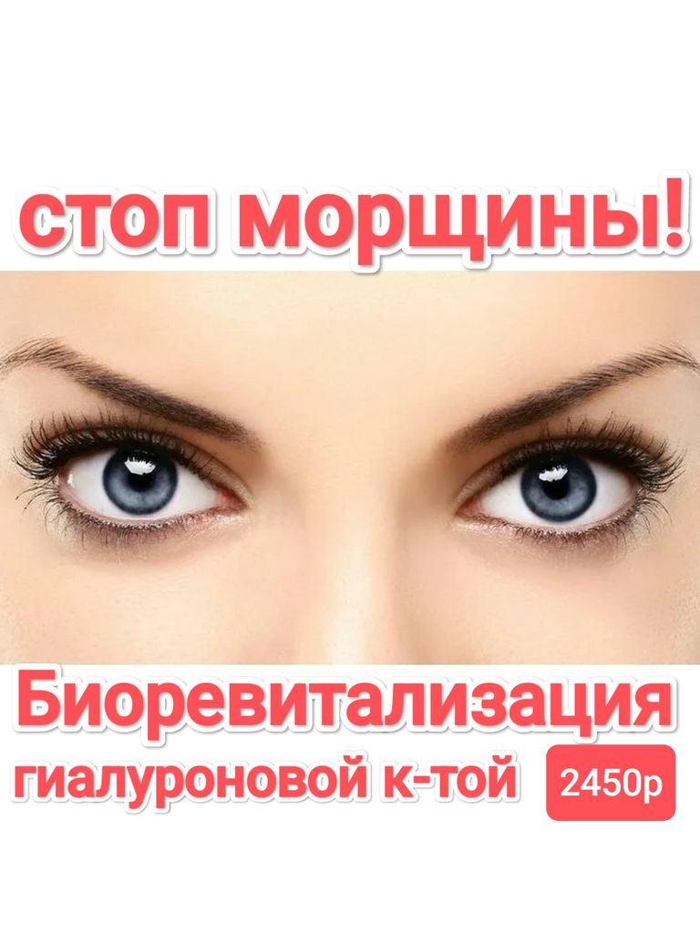 Инъекционная биоревитализация препаратом гиалуроновой кислоты «Репарт №4», 1 мл