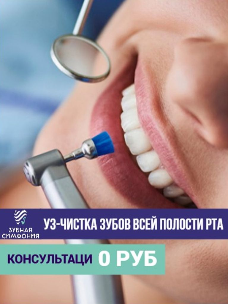 УЗ-чистка зубов всей полости рта