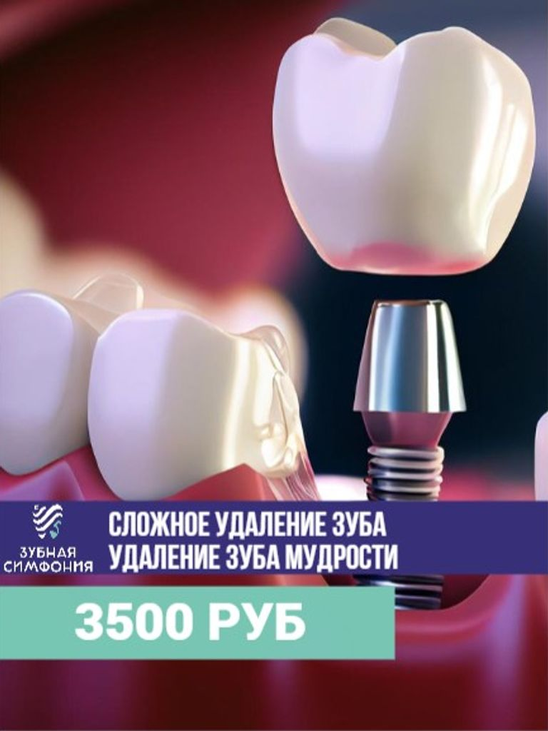 Имплантация 1 зуба Dentium IMPLANT «Под ключ» (Юж. Корея)