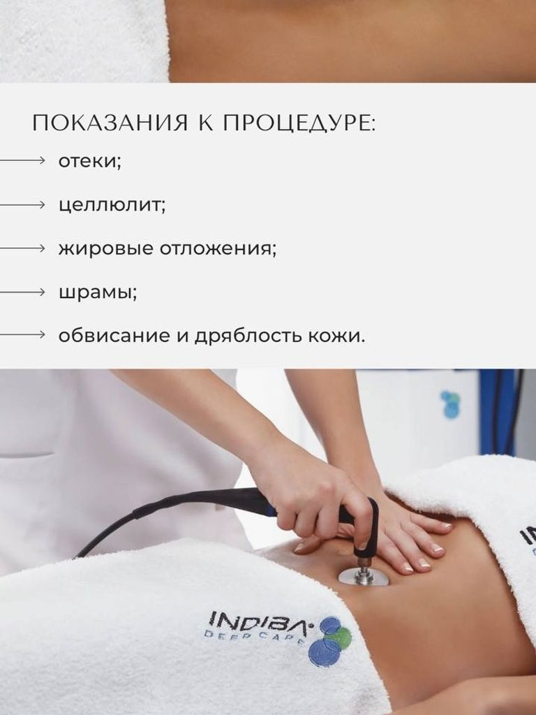 Абонемент на 10 сеансов комплекса коррекции фигуры на аппарате Indiba 1 зоны на выбор