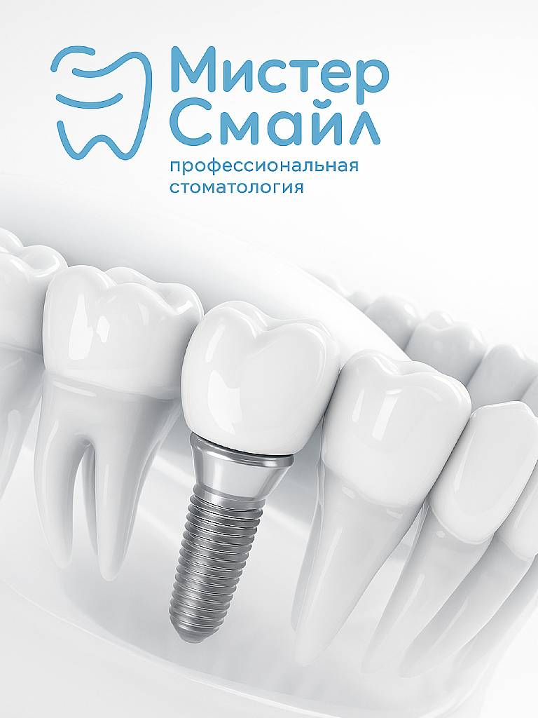 Установка импланта системы Osstem + металлокерамическая коронка