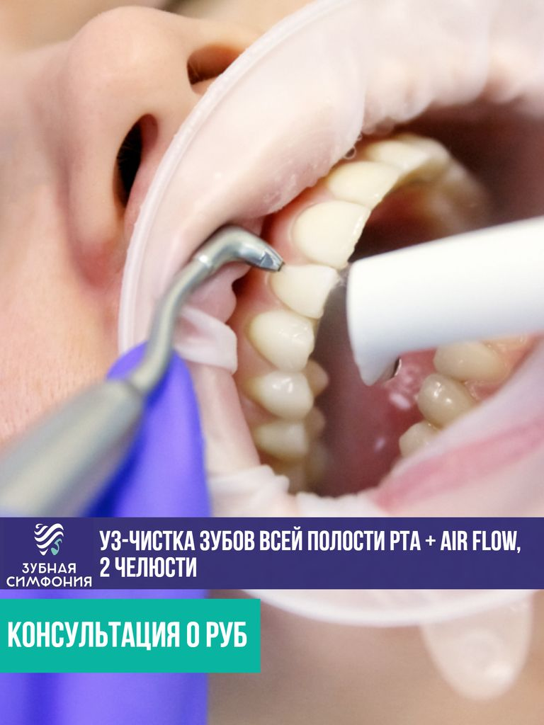 УЗ-чистка зубов всей полости рта + Air Flow, 2 челюсти