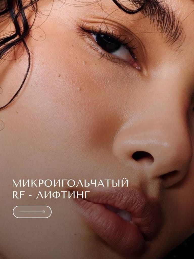 Микроигольчатый RF-лифтинг зоны лица