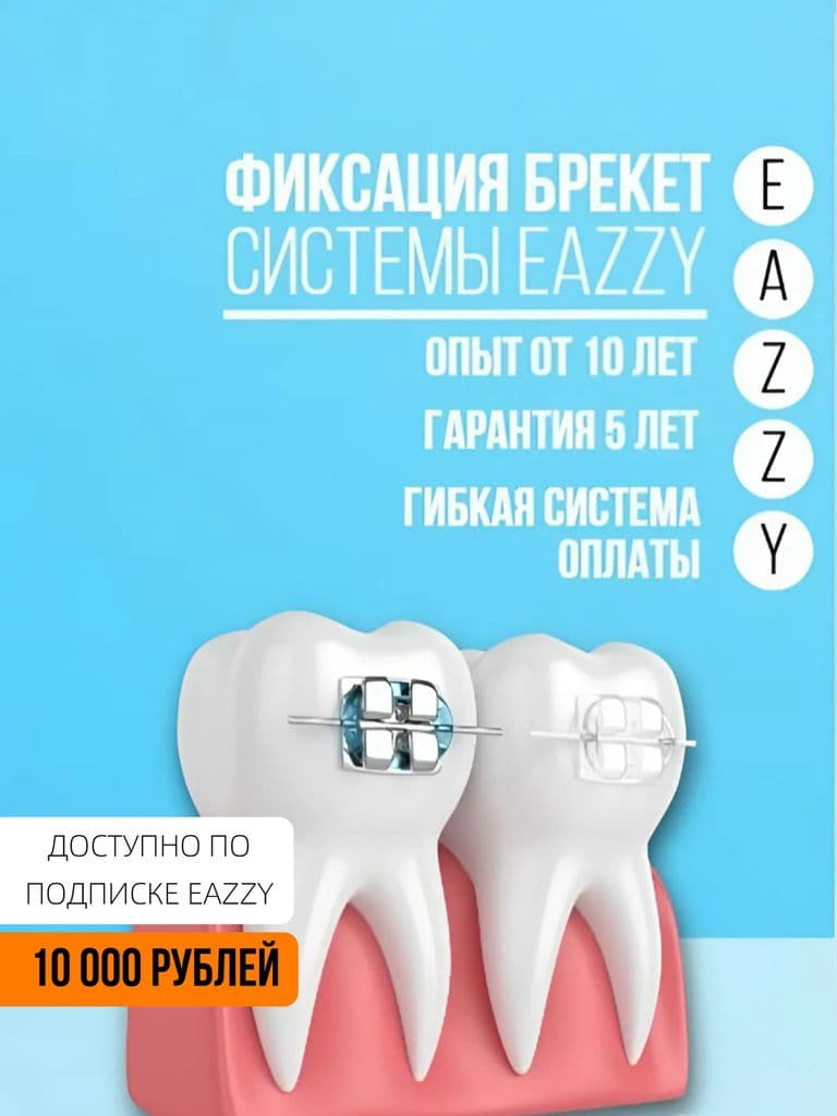 Фиксация брекет системы: EAZZY брекеты