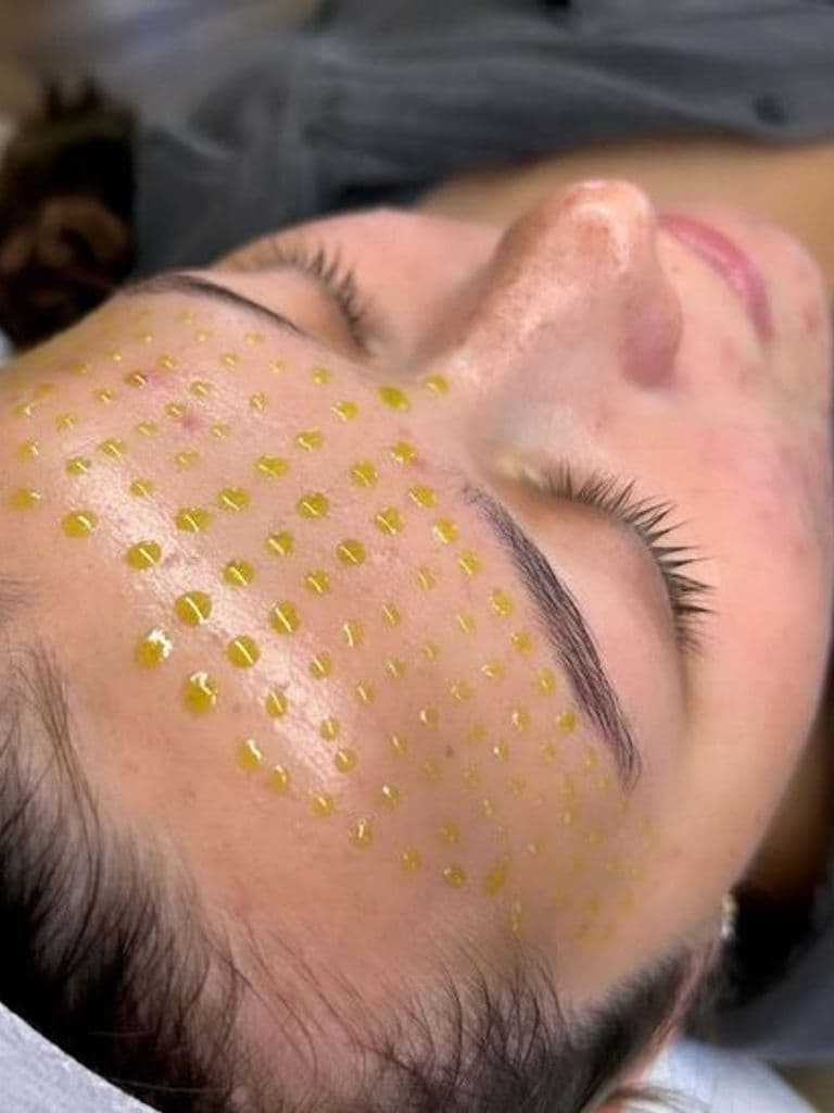 Пилинг лица на выбор