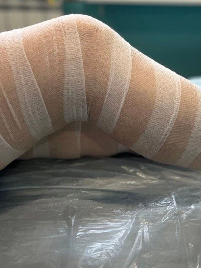 Фито-солевое обертывание