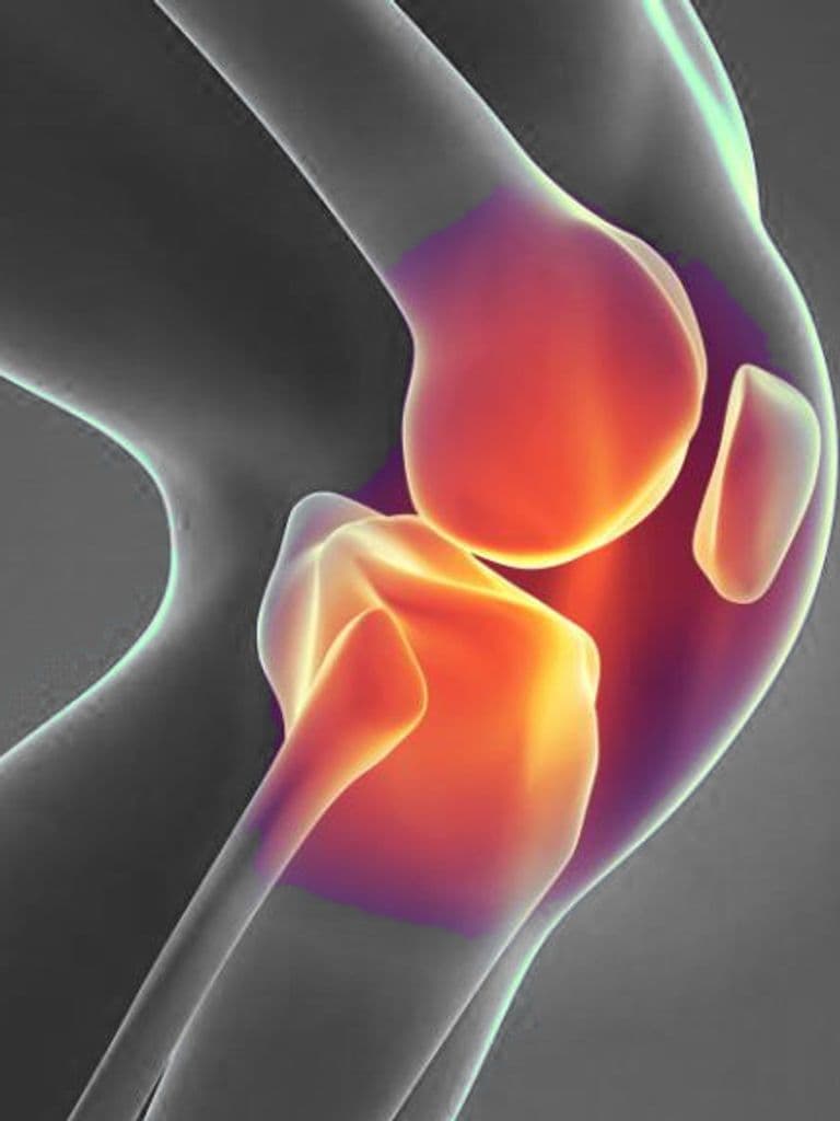 КТ суставов