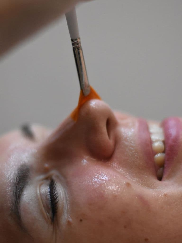 Поверхностный пилинг на выбор