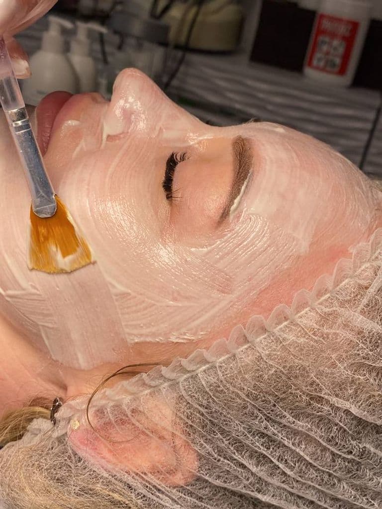 Микроигольчатый пилинг