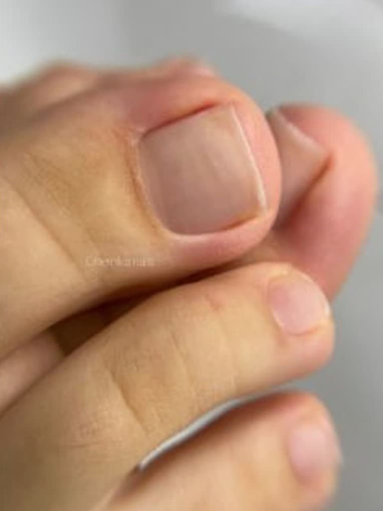 Гигиенический педикюр