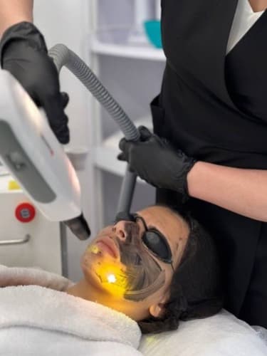 Пилинг лица