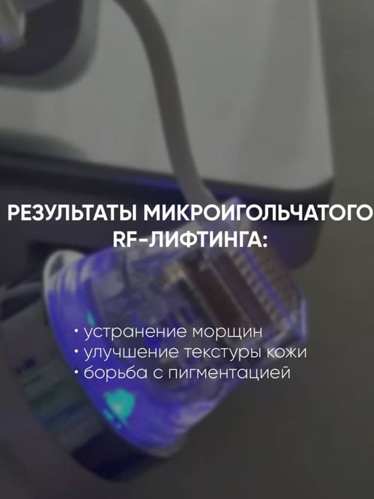 Микроигольчатый RF-лифтинг