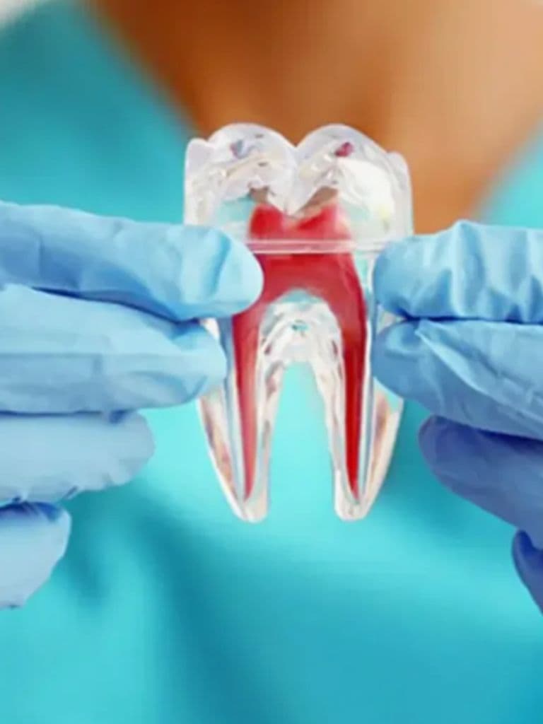 Лечения периодонтита