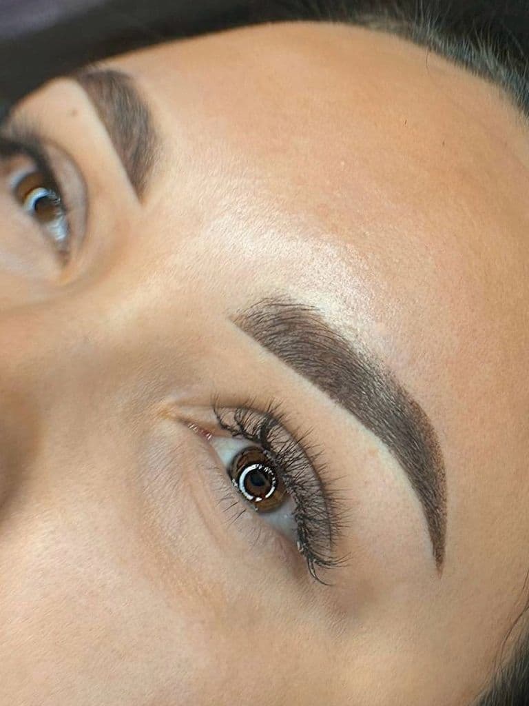 Лазерное удаление перманентного макияжа бровей