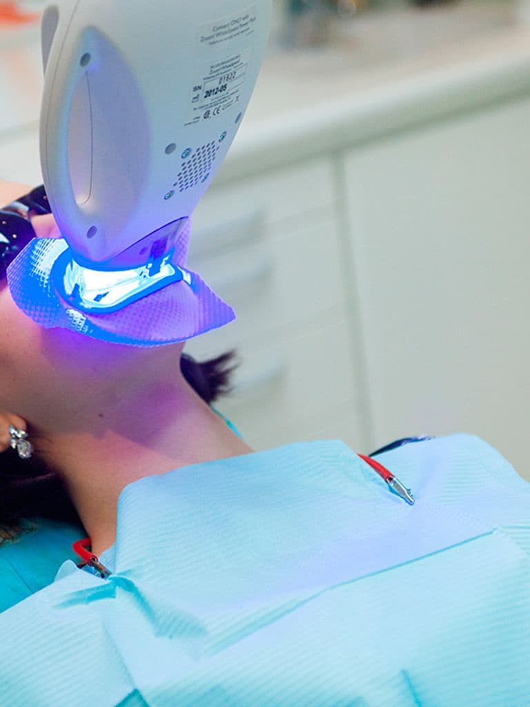 Профессиональное отбеливание зубов системой Flash (Германия)