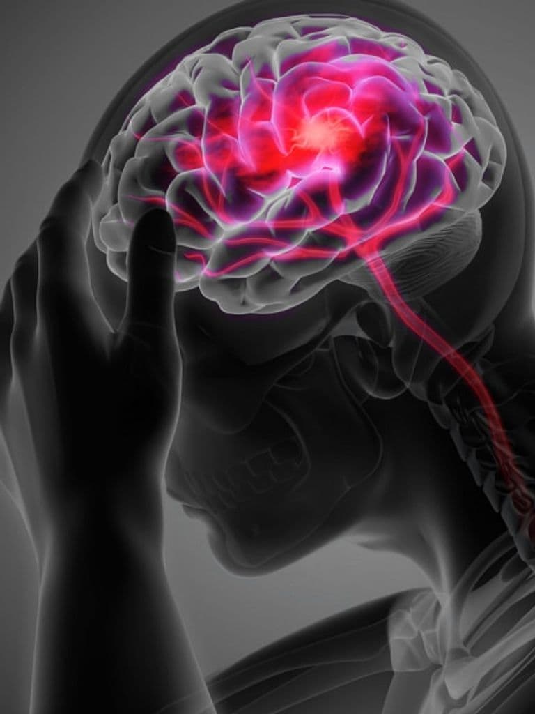 МРТ головного мозга