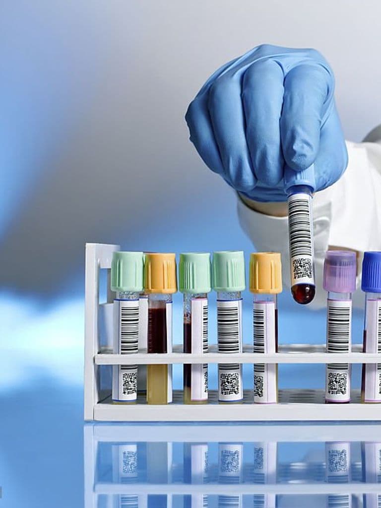 Анализ «Щитовидная железа, скрининг»