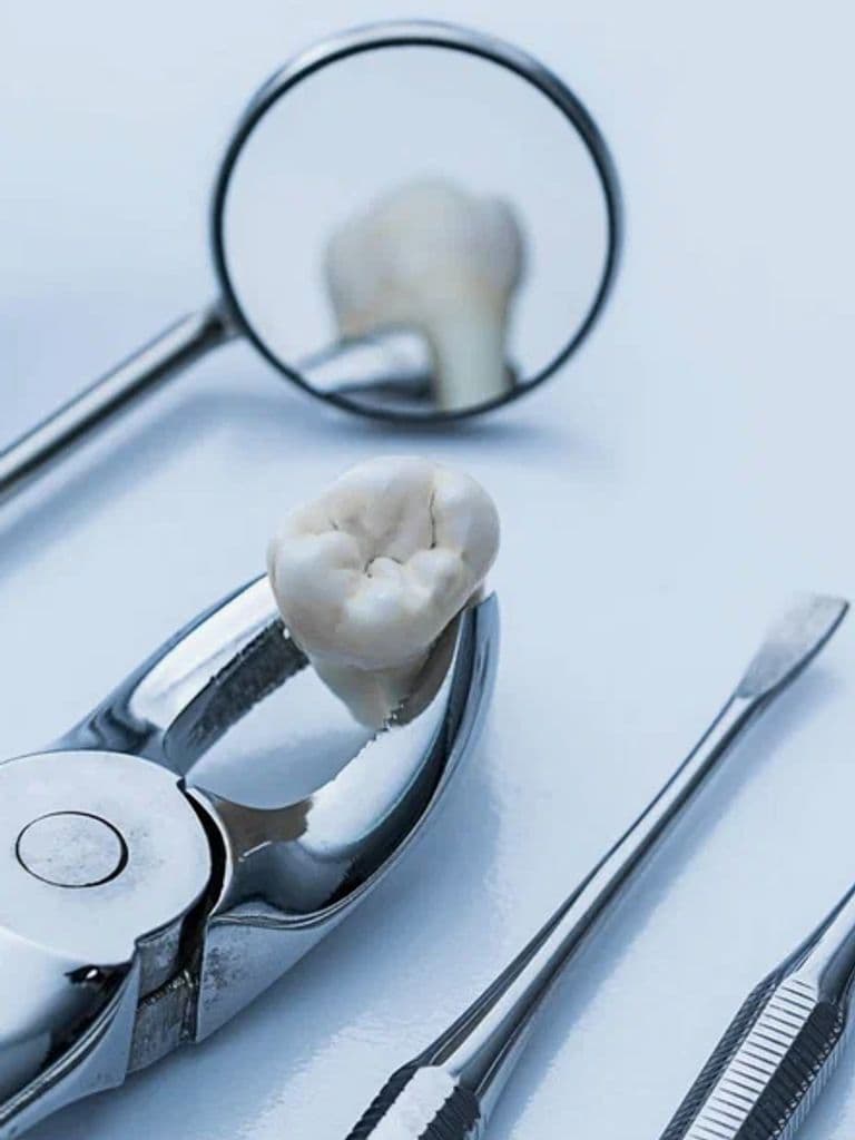 Лечения пульпита