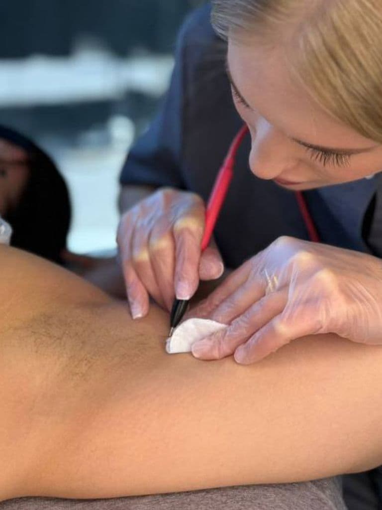 Электроэпиляция, 1 ч.