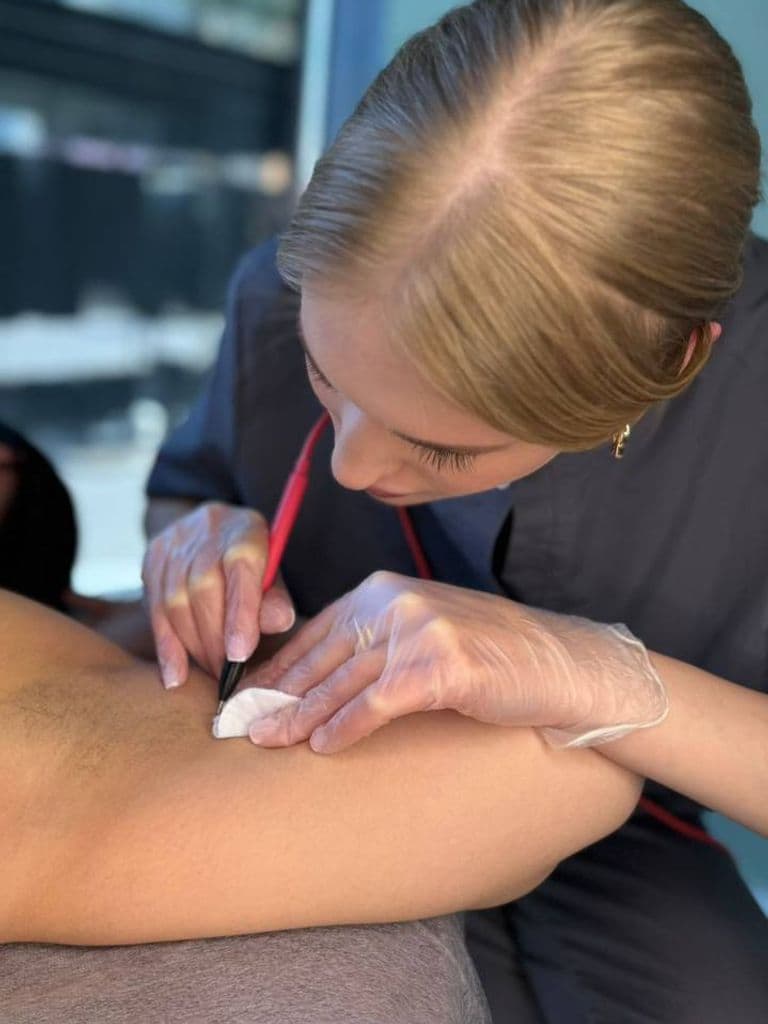 Электроэпиляция, 1 ч.