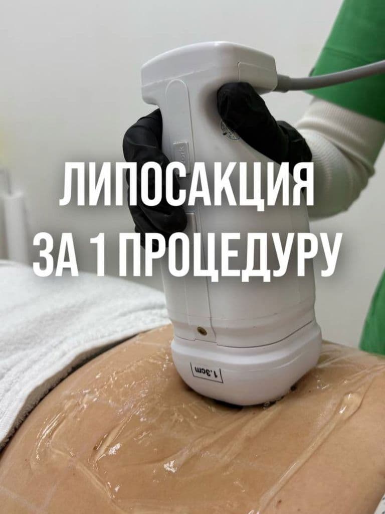 Коррекция фигуры липосоникс