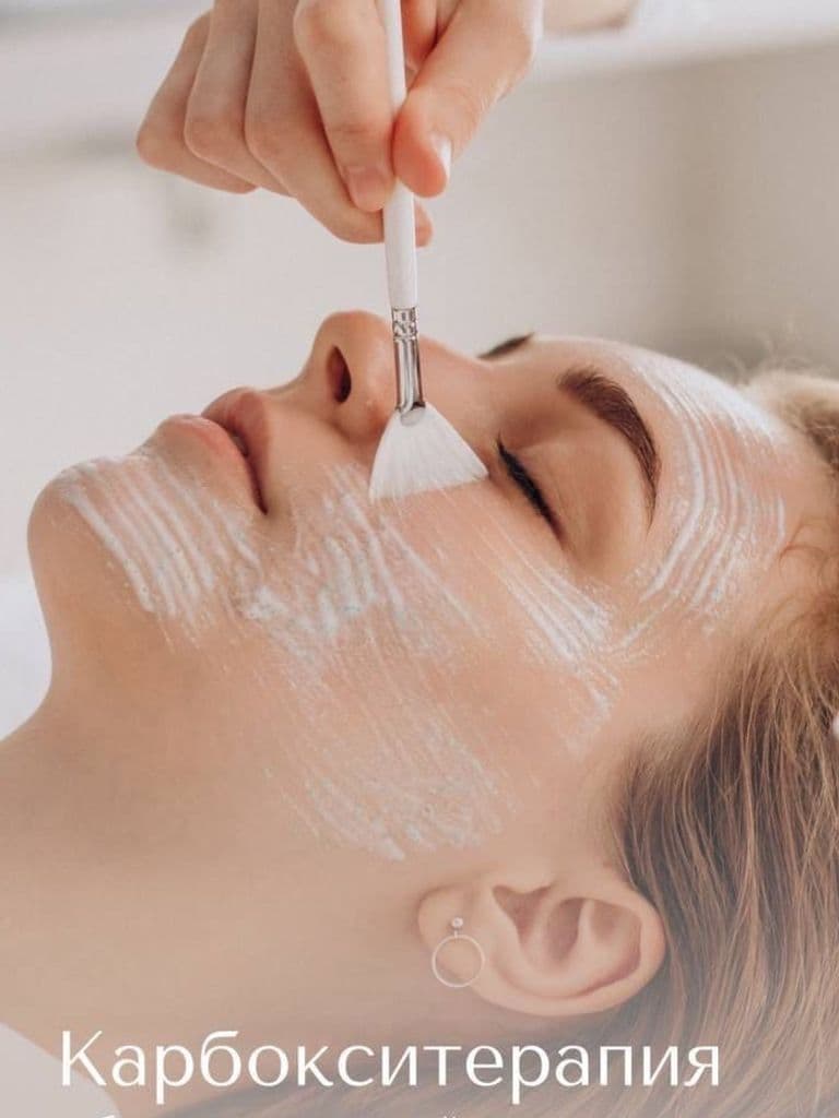 Карбокситерапия