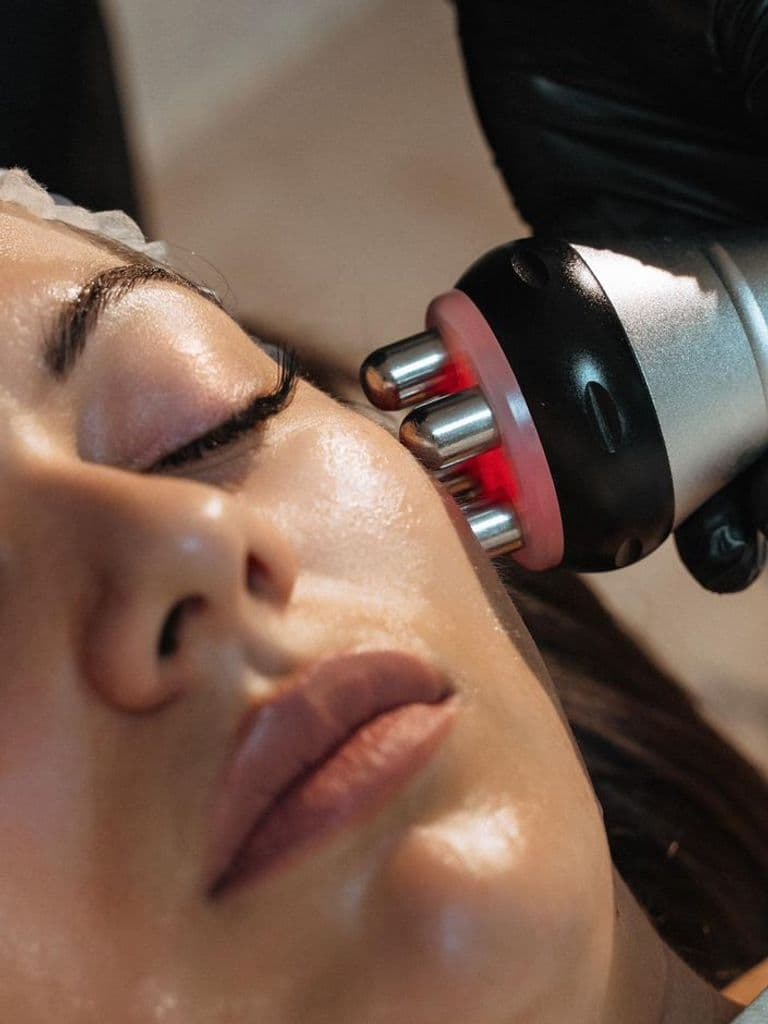 RF-лифтинг лица