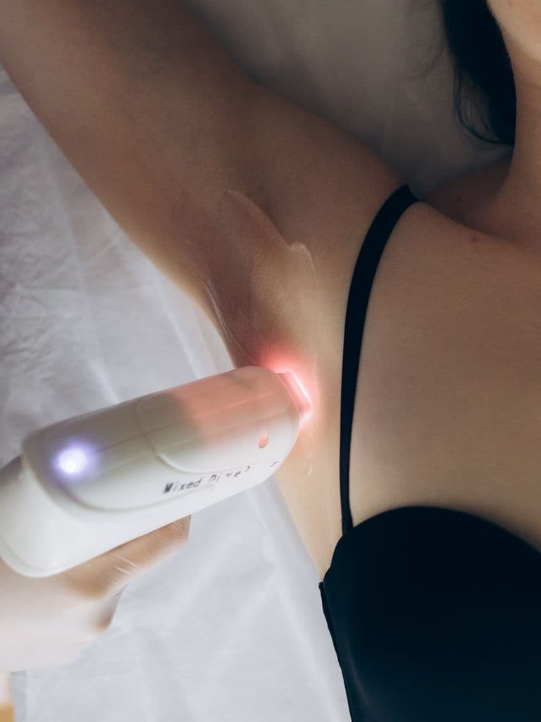 Комплекс лазерной эпиляции №1