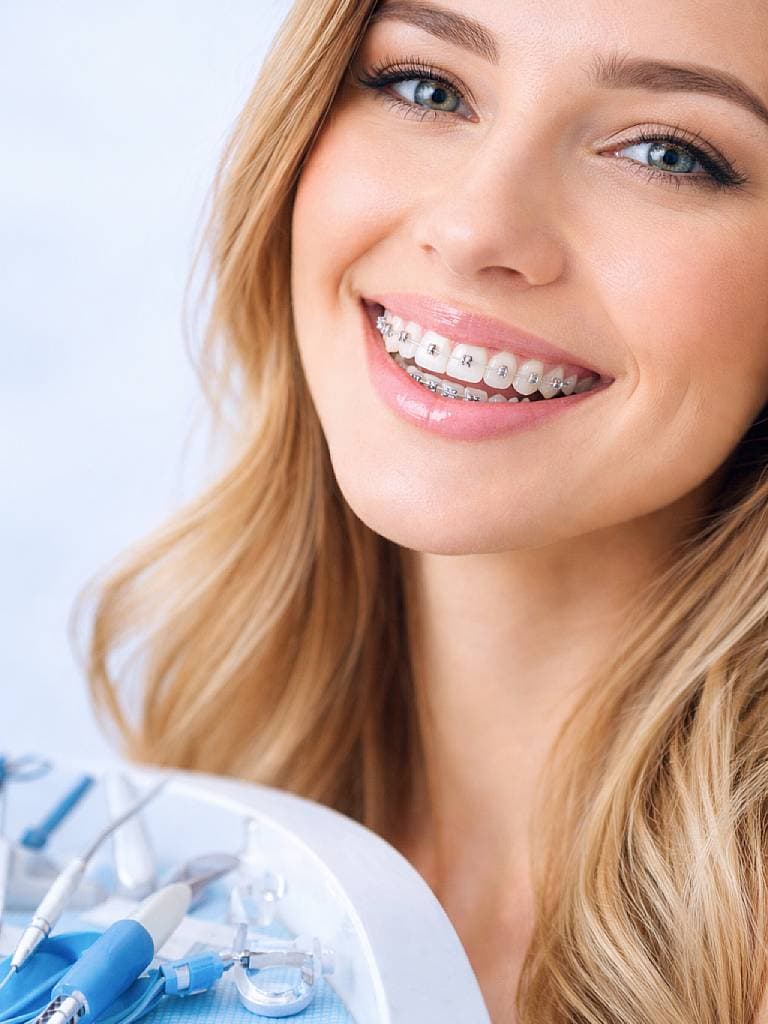 Установка брекетов