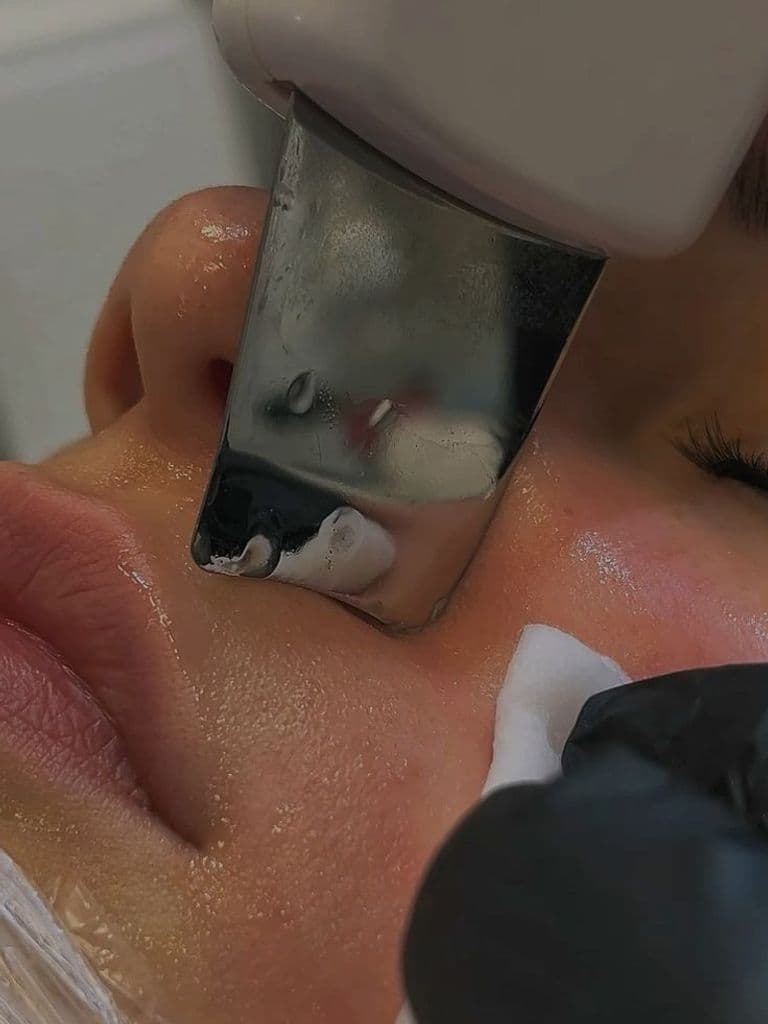 Ультразвуковая чистка лица