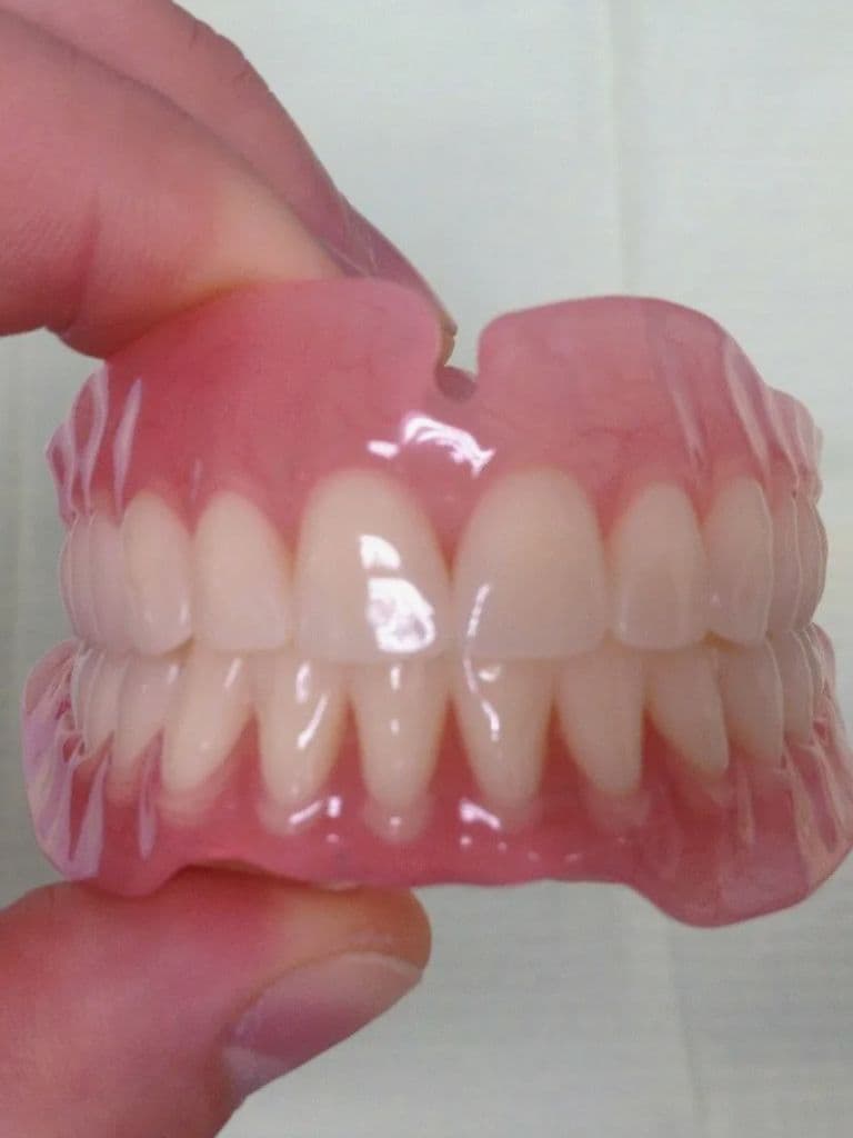 Полный съемный протез (на одну челюсть)