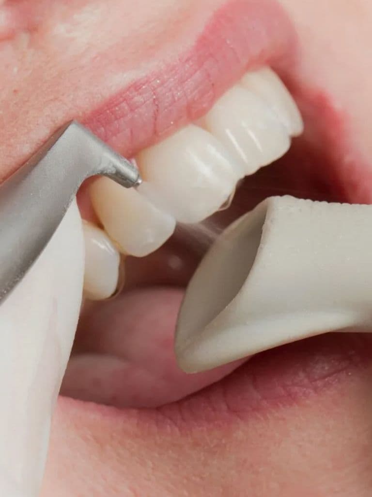 Профессиональная гигиена полости рта с Air Flow