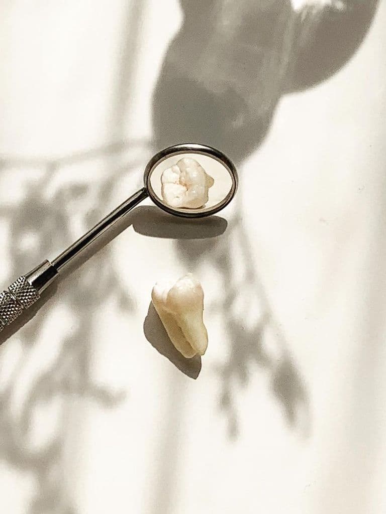 Удаление зубов