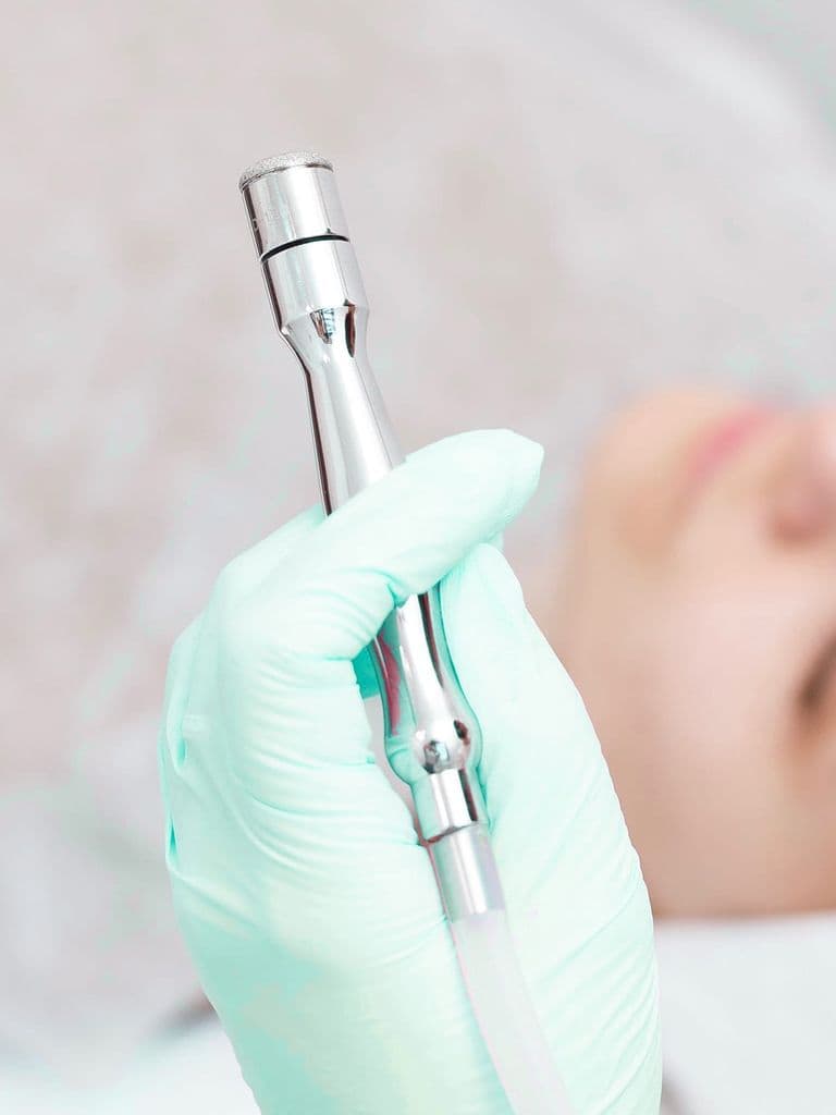 Алмазная дермабразия лица