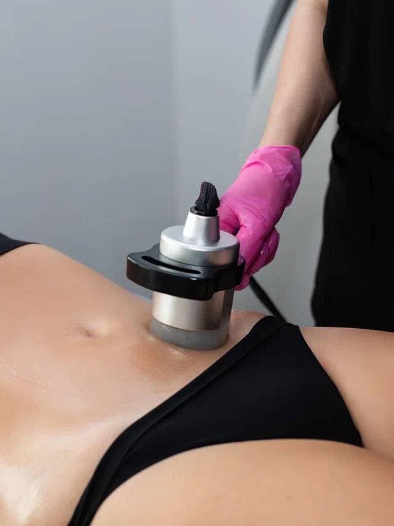 RF-лифтинг 1 зоны, 30 мин.