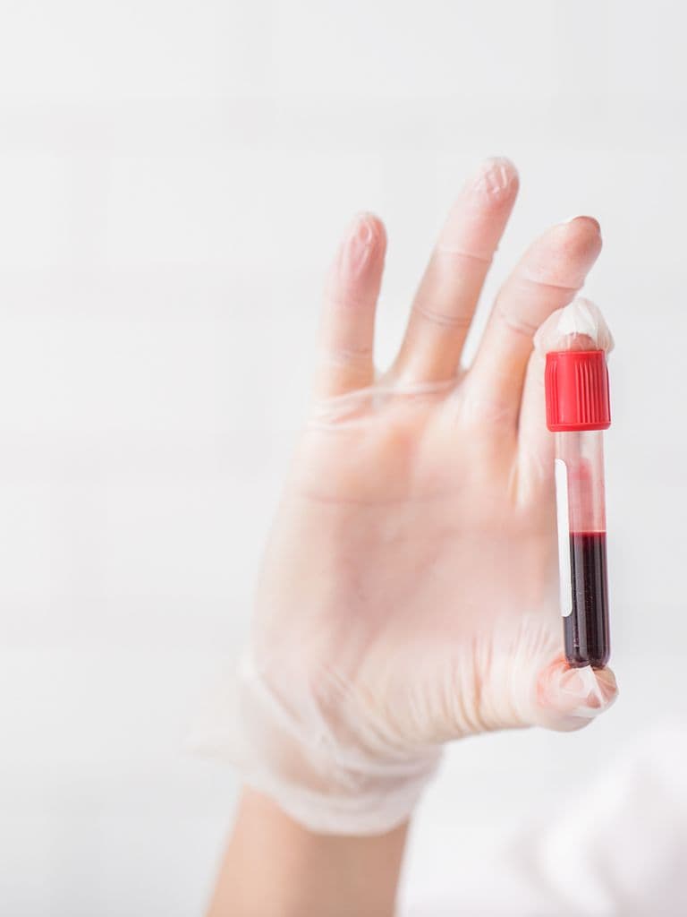 Исследование женского гормонального статуса