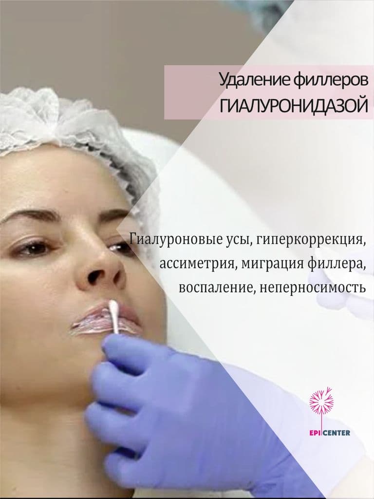 Удаление филлера ферментом гиалуронидаза