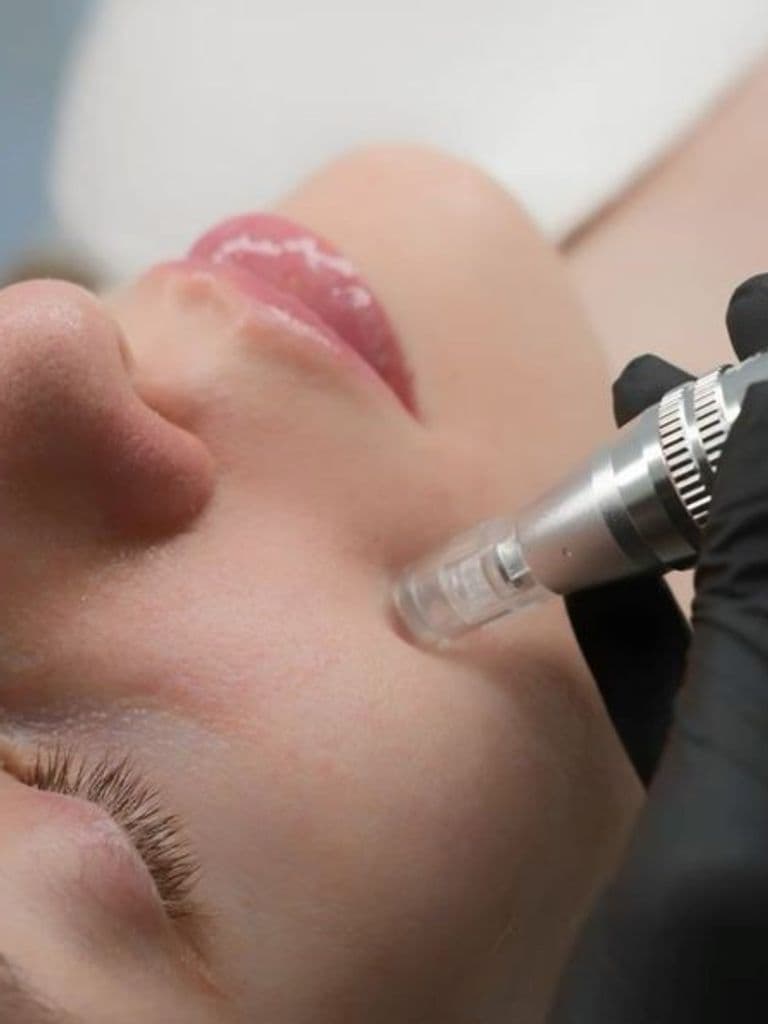 Фракционная мезотерапия (безинъекционная), 60 мин.