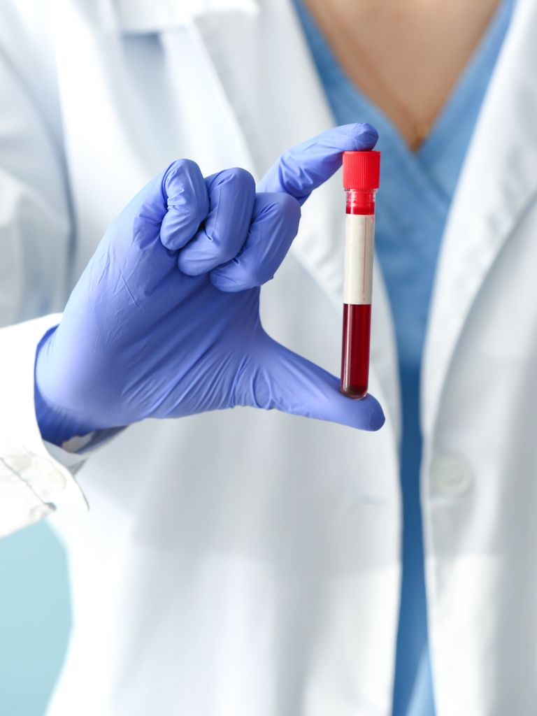 Анализ «7 показателей здоровья сердца и сосудов»