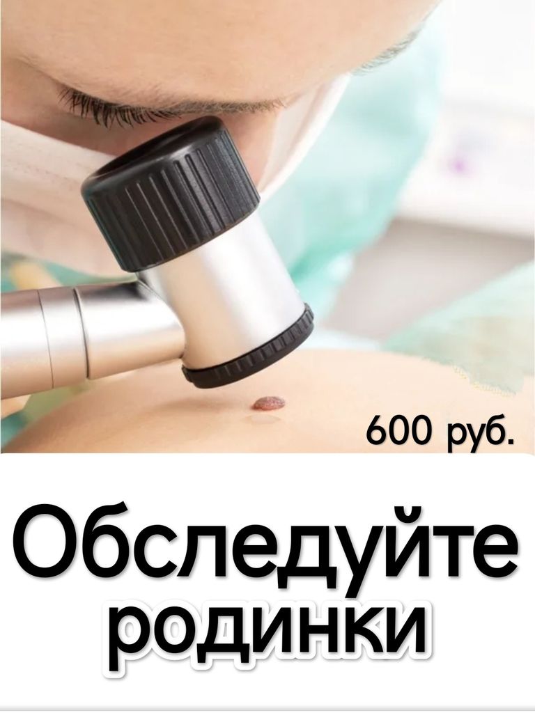 Дерматоскопия новообразований