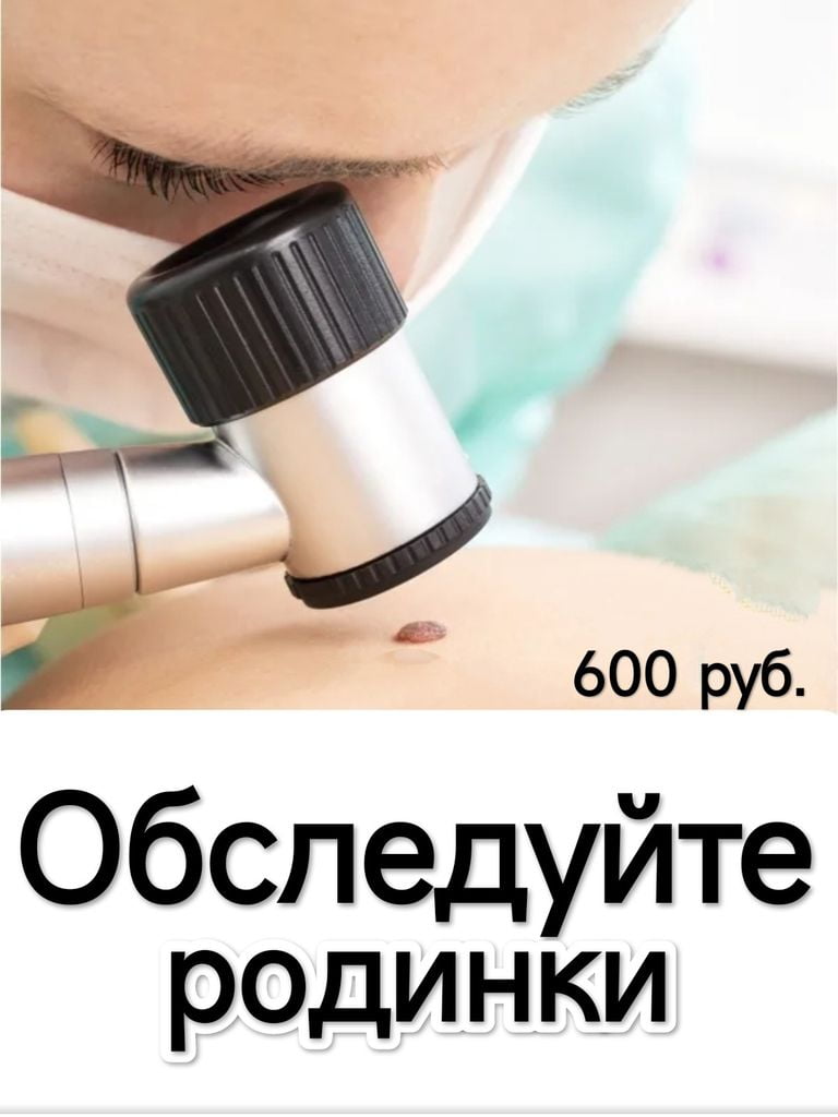 Дерматоскопия новообразований