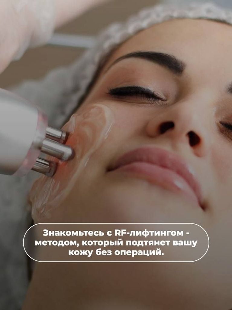 Пробный сеанс RF-лифтинга зоны лица