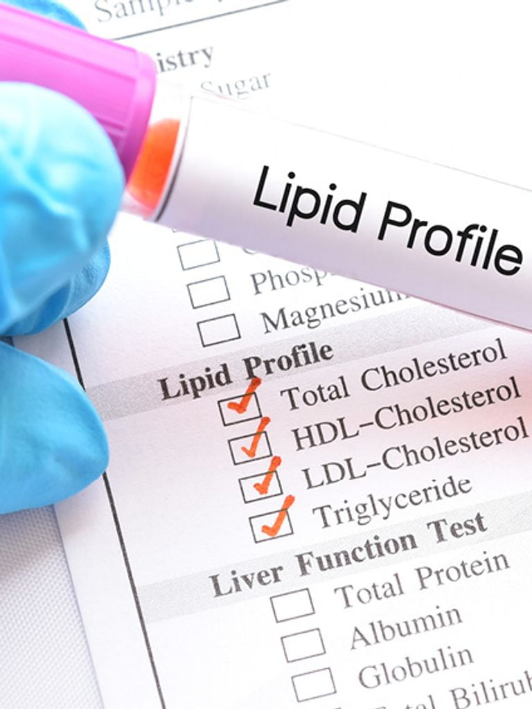 Липидограмма