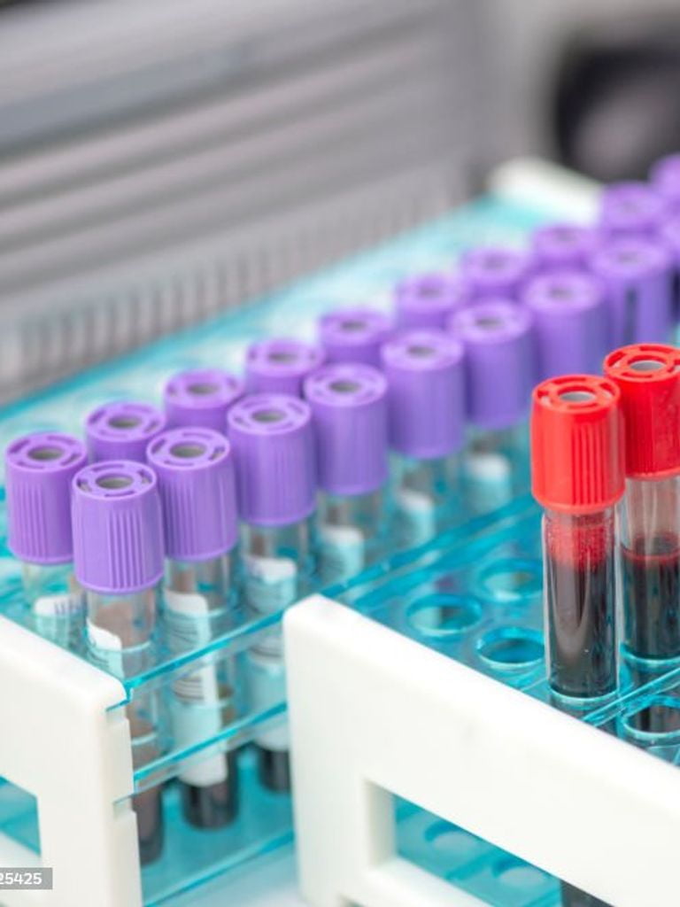 Анализ «Здоровье щитовидной железы»