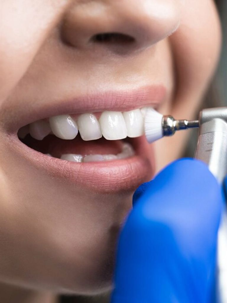 Гигиена полости рта с AirFlow